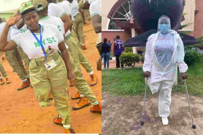 Young Nigerian Lady Whose Leg Was Amputated Graduates With Two Degrees From University