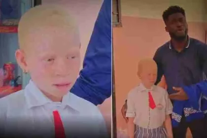 Young albino girl whose parent stopped from going to school for 4 years gets scholarship from a generous Nigerian man