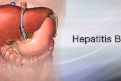 In Sierra Leone- Over 1 million people live with Chronic Hepatitis B
