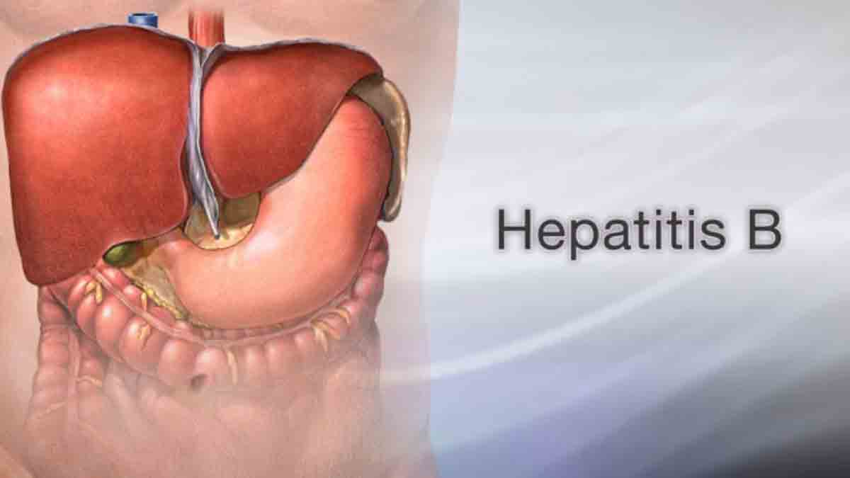 In Sierra Leone- Over 1 million people live with Chronic Hepatitis B In Sierra Leone- Over 1 million people live with Chronic Hepatitis B