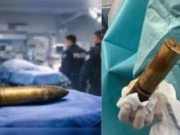French Hospital Evacuated After World War I Artillery Shell Found Inside Man’s Rectum